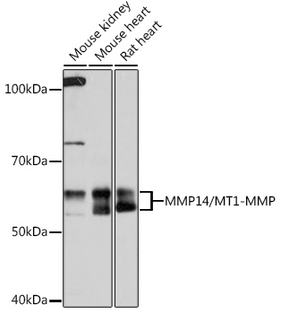 MMP14/MT1-MMP Rabbit mAb