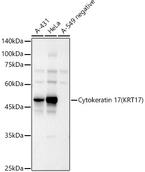 Cytokeratin 17 (KRT17) Rabbit pAb