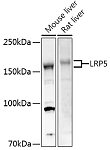 Western blot - LRP5 Rabbit pAb (A0130)