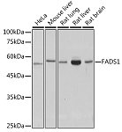 Western blot - FADS1 Rabbit mAb (A0178)