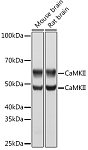 Western blot - CaMK2 delta/CAMK2 gamma Rabbit mAb (A0186)