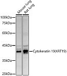Western blot - Cytokeratin 19 (KRT19) Rabbit pAb (A0247)