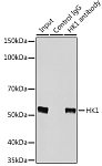 Immunohistochemistry - p53 Rabbit pAb (A0263)