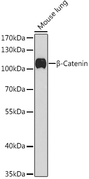 β-Catenin Rabbit pAb