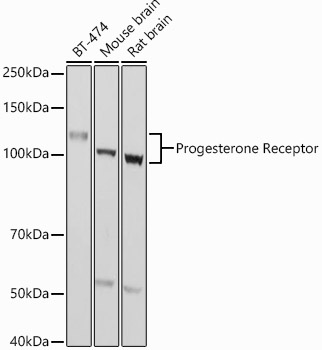 Progesterone Receptor Rabbit pAb