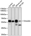 Western blot - Vimentin Rabbit pAb (A0326)