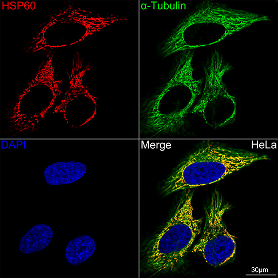 HSP60/HSPD1 Rabbit mAb