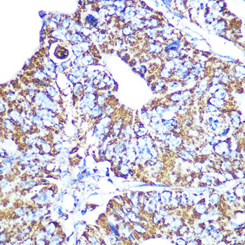 HSP60/HSPD1 Rabbit mAb