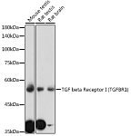 Western blot - TGF beta Receptor I (TGFBR1) Rabbit pAb (A0708)