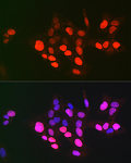 Immunofluorescence - DNA topoisomerase II alpha (TOP2A) Rabbit pAb (A0726)