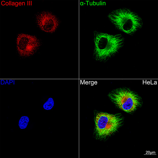 Collagen III alpha 1/COL3A1 Rabbit mAb