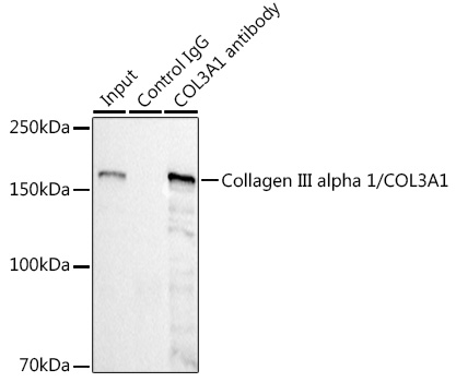 Collagen III alpha 1/COL3A1 Rabbit mAb