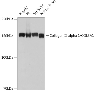 Collagen III alpha 1/COL3A1 Rabbit mAb