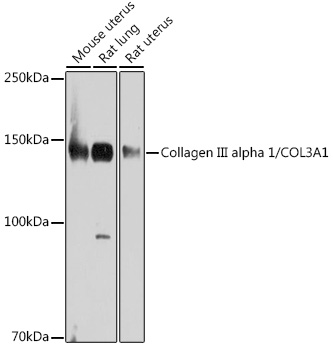 Collagen III alpha 1/COL3A1 Rabbit mAb