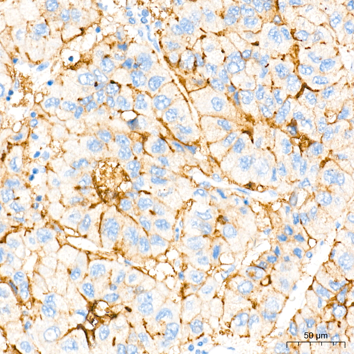 SR-BI Rabbit mAb