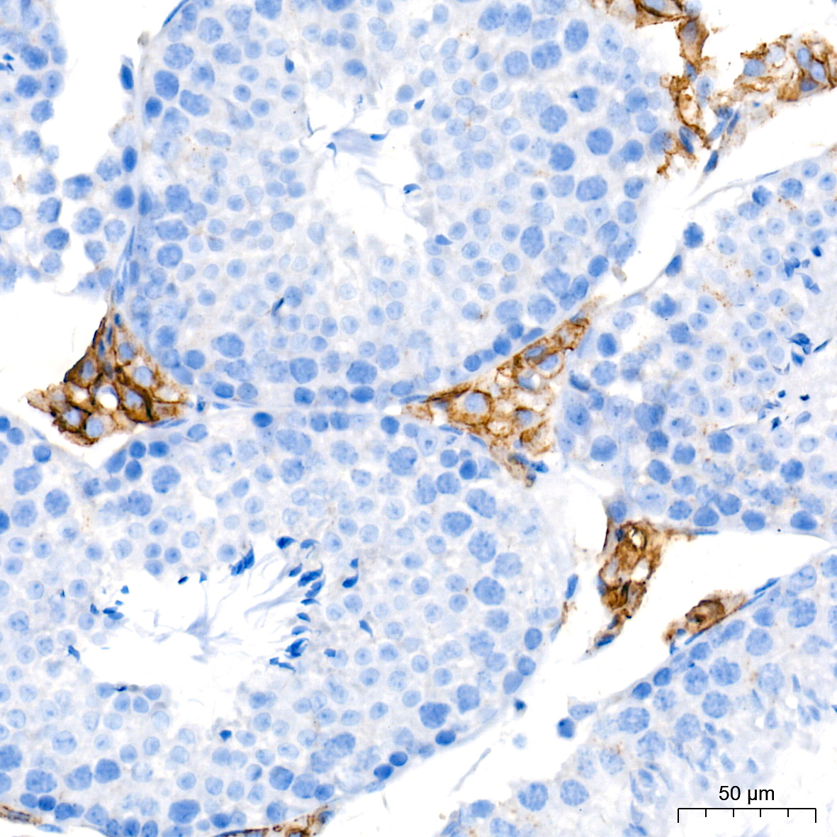 SR-BI Rabbit mAb