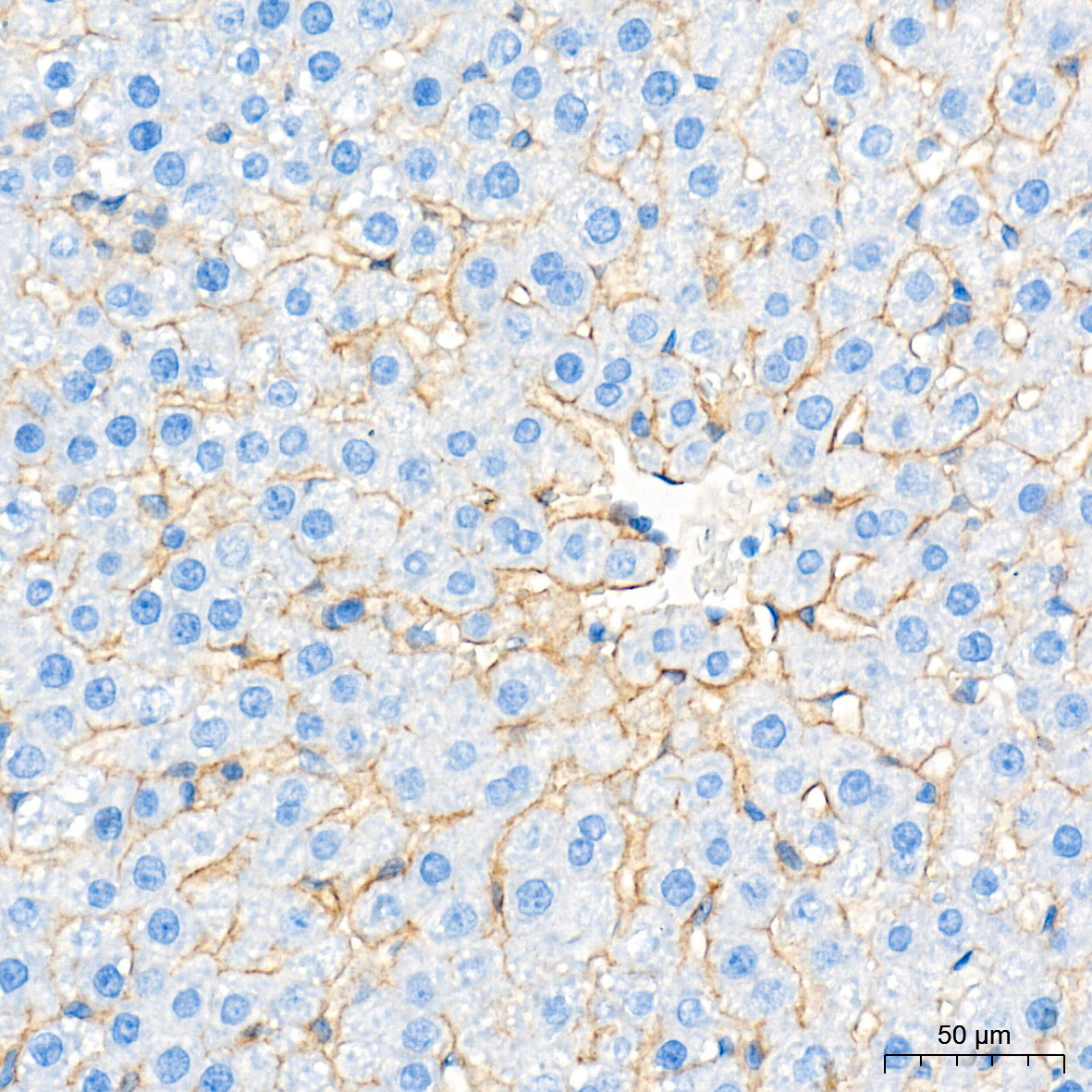 SR-BI Rabbit mAb