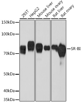 SR-BI Rabbit mAb