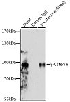 Western blot - γ-Catenin Rabbit pAb (A0963)