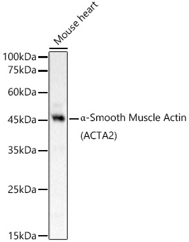 α-Smooth Muscle Actin (ACTA2) Rabbit pAb