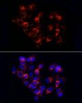 Western blot - Alpha-1 Antitrypsin (SERPINA1) Rabbit pAb (A1015)