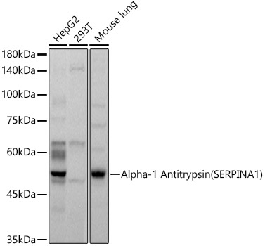 Alpha-1 Antitrypsin (SERPINA1) Rabbit pAb