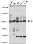 Western blot - DSC2 Rabbit pAb (A10211)