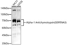Western blot - Alpha-1 Antichymotrypsin (SERPINA3) Rabbit pAb (A1021)