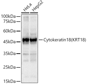 Cytokeratin 18 (KRT18) Rabbit pAb