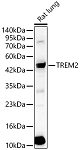 Western blot - TREM2 Rabbit pAb (A10482)