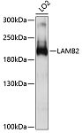 Western blot - LAMB2 Rabbit pAb (A10565)