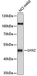 Western blot - LHX2 Rabbit pAb (A10803)