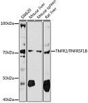 Western blot - TNFR2/TNFRSF1B Rabbit pAb (A1095)