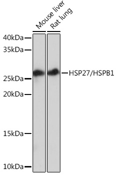 HSP27/HSPB1 Rabbit mAb