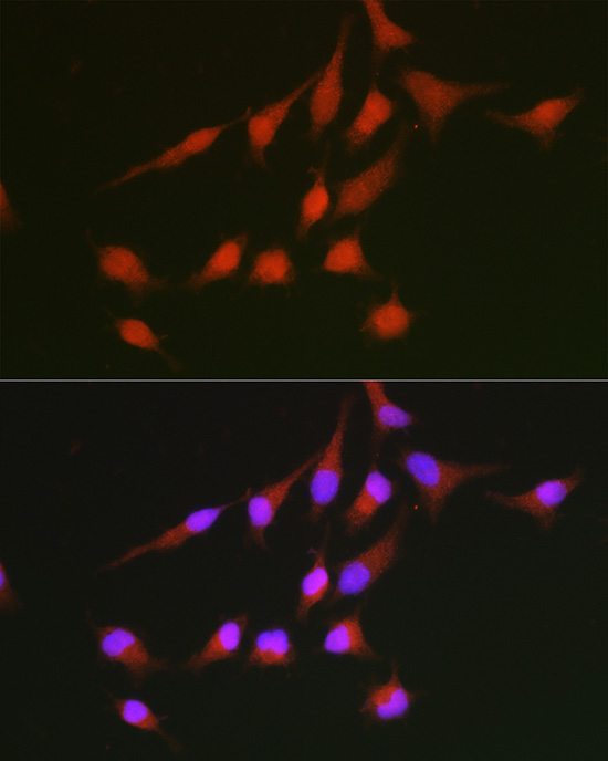 ABclonal:Immunofluorescence - NRF2 Rabbit pAb (A11159)