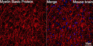 Western blot - Myelin Basic Protein Rabbit mAb (A11162)