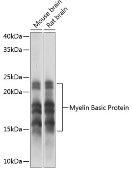Myelin Basic Protein Rabbit mAb