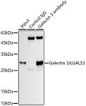 Western blot - Galectin 3/LGALS3 Rabbit mAb (A11198)