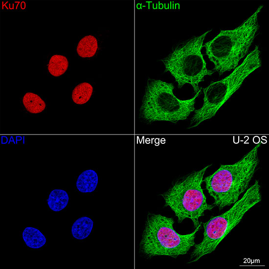 Ku70 Rabbit mAb