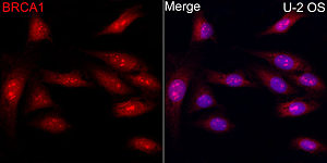 Immunofluorescence - BRCA1 Rabbit pAb (A11318)
