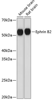 Ephrin B2 Rabbit mAb