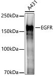 Western blot - EGFR Rabbit pAb (A11351)