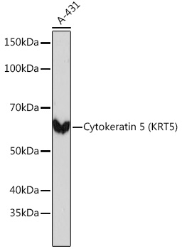 Cytokeratin 5 (CK5) Rabbit mAb