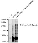 Western blot - δ-Catenin/p120 Catenin Rabbit mAb (A11399)