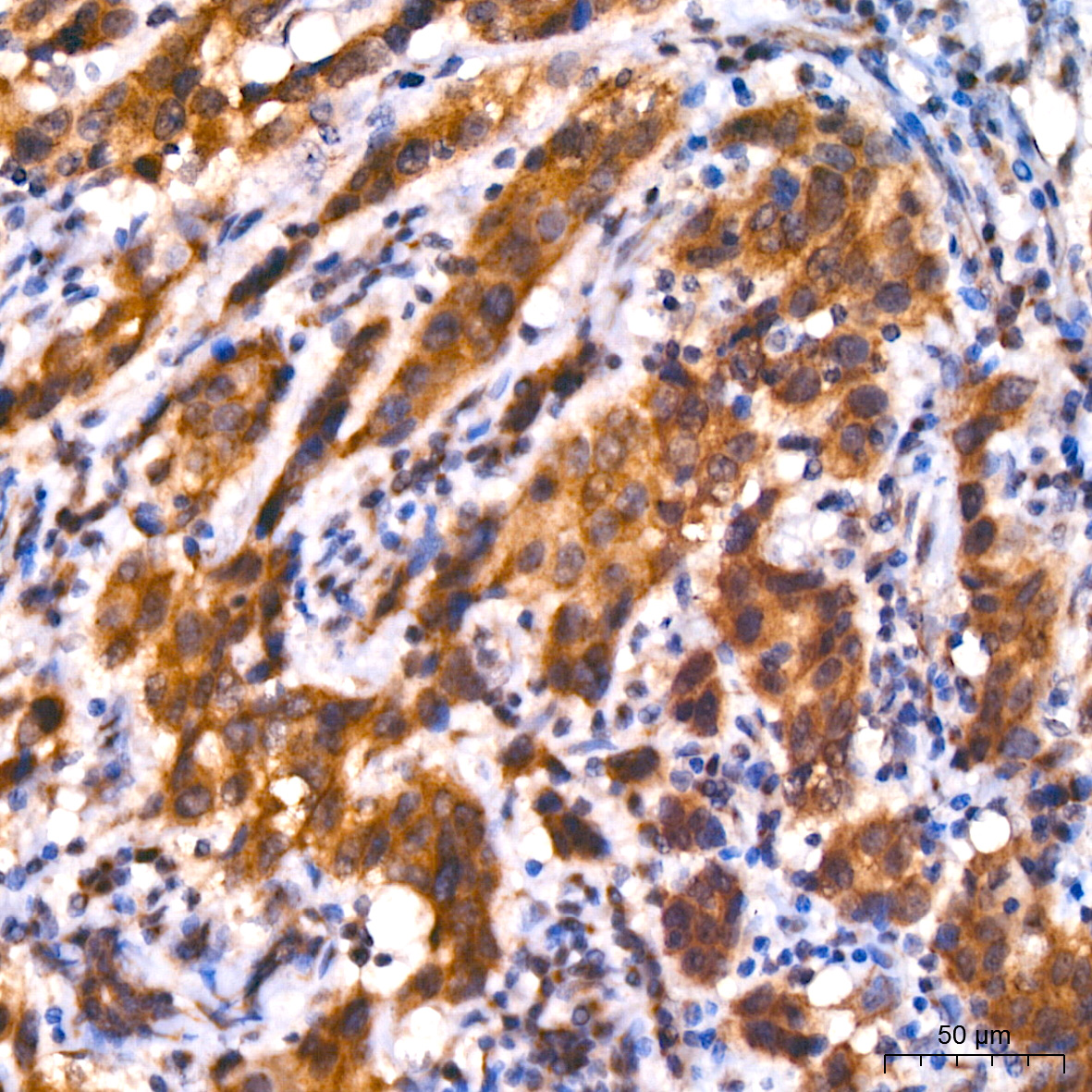 GM130 Rabbit mAb