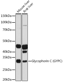Glycophorin C (GYPC) Rabbit mAb