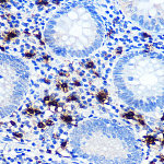 Western blot - Mast Cell Chymase (CMA1) Rabbit mAb (A11480)