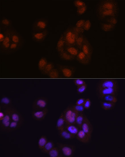 FGF2 Rabbit mAb