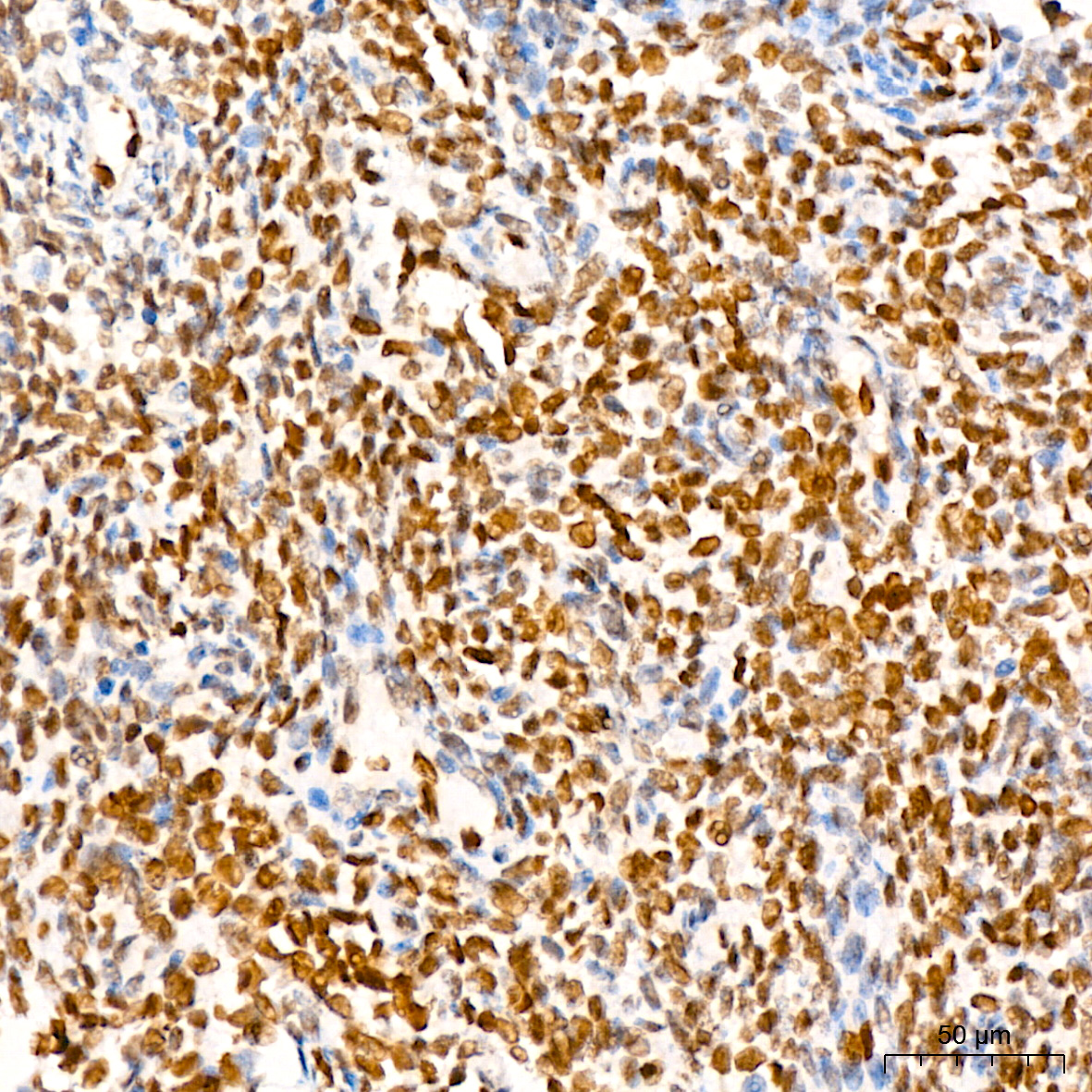 FGF2 Rabbit mAb