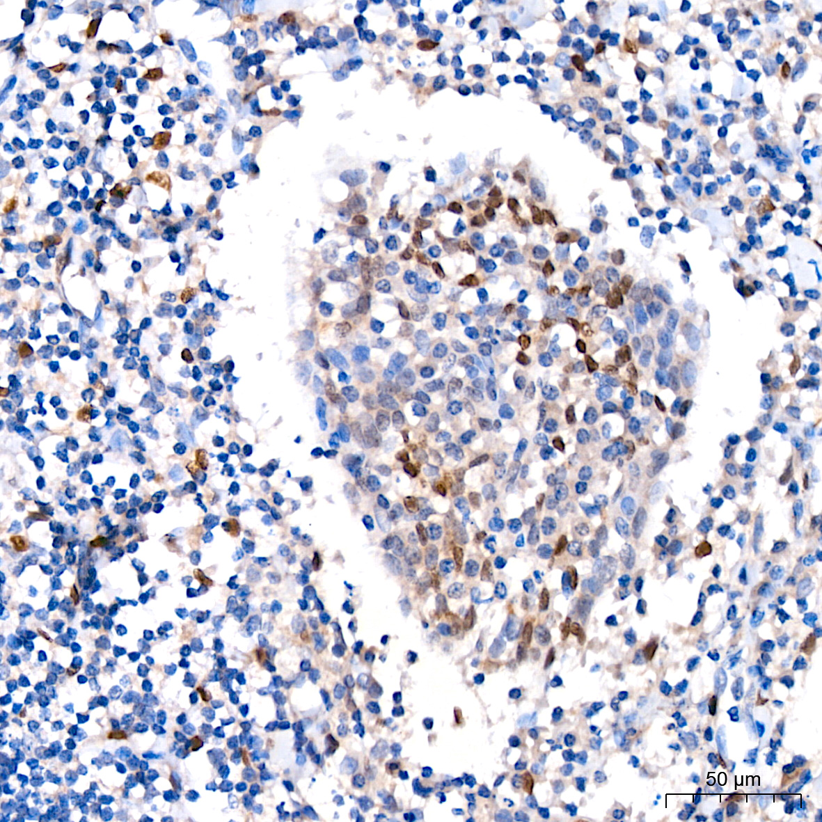 FGF2 Rabbit mAb